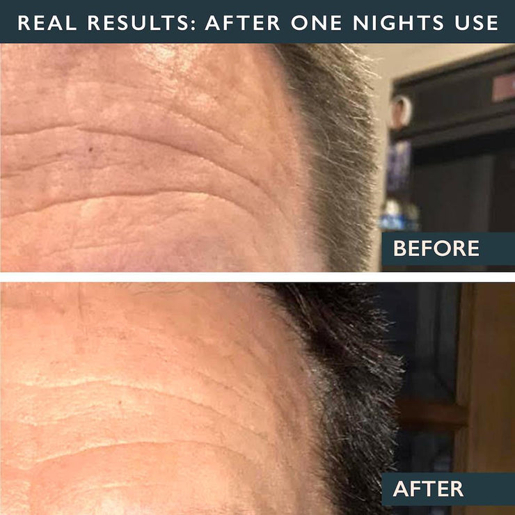Men's Forehead Smoothing Kit