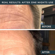 Men's Forehead Smoothing Kit